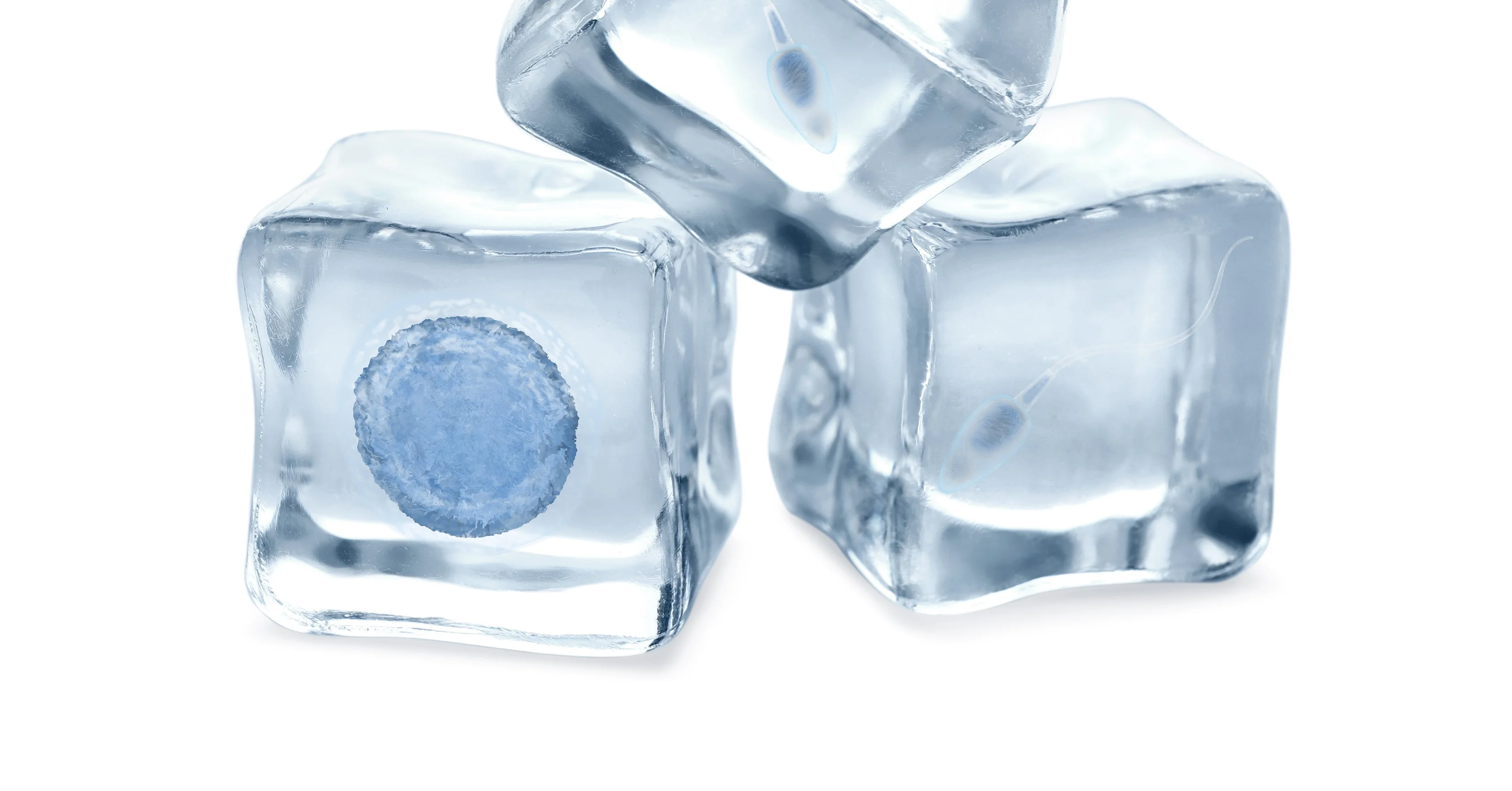 Criopreservación de ovocitos